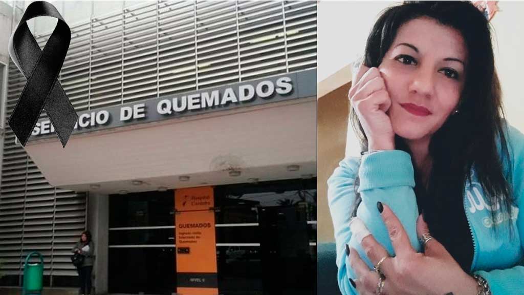 Falleció la joven que se quemó accidentalmente con una estufa